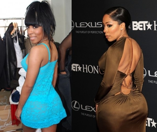 A picture of K. Michelle before and after plastic butt implants.